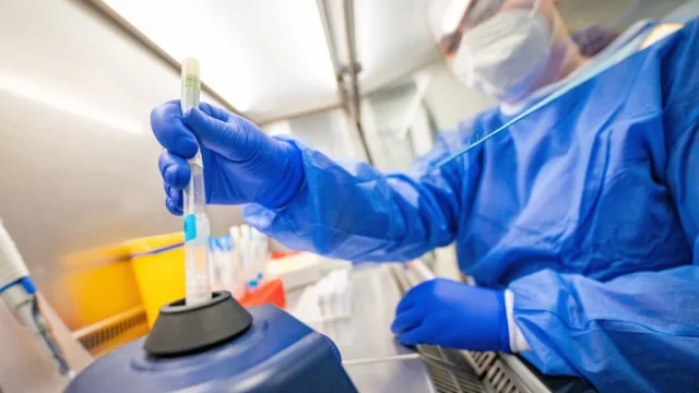 Humanos contagian más virus a animales que viceversa, revela estudio