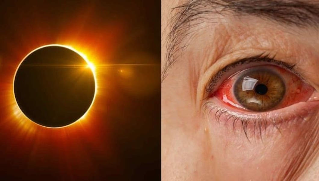 Aumentan búsquedas en Google sobre dolor ocular tras eclipse ¿por qué?