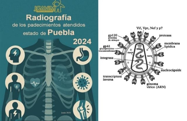 incremento vih Puebla 2024