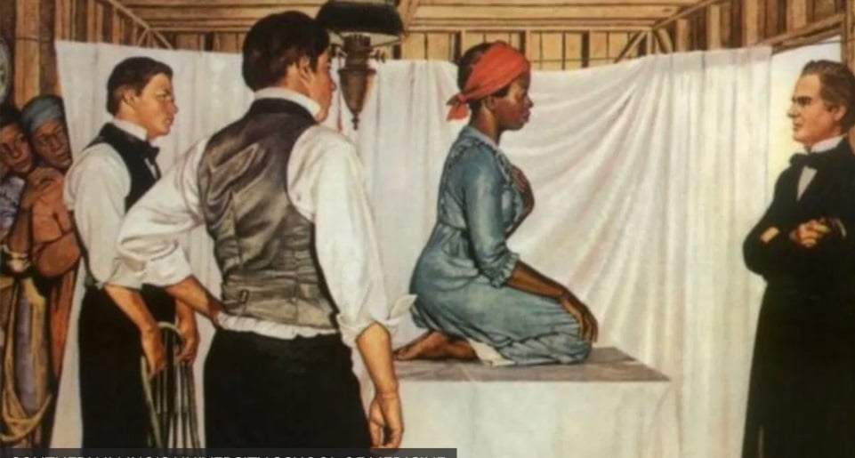 “Fueron borradas de los libros”: Reivindican a Anarcha, Lucy y Betsey, mujeres esclavizadas, madres de la ginecología moderna