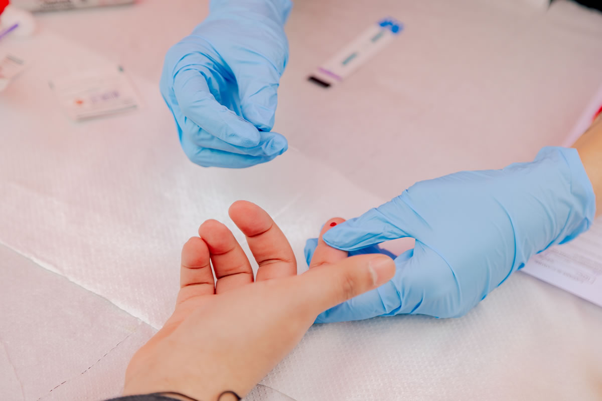 Syphilis Cases Surge Among Seniors in Chile: Instances Among Women Aged 60 and Older Doubled in Just Four Years